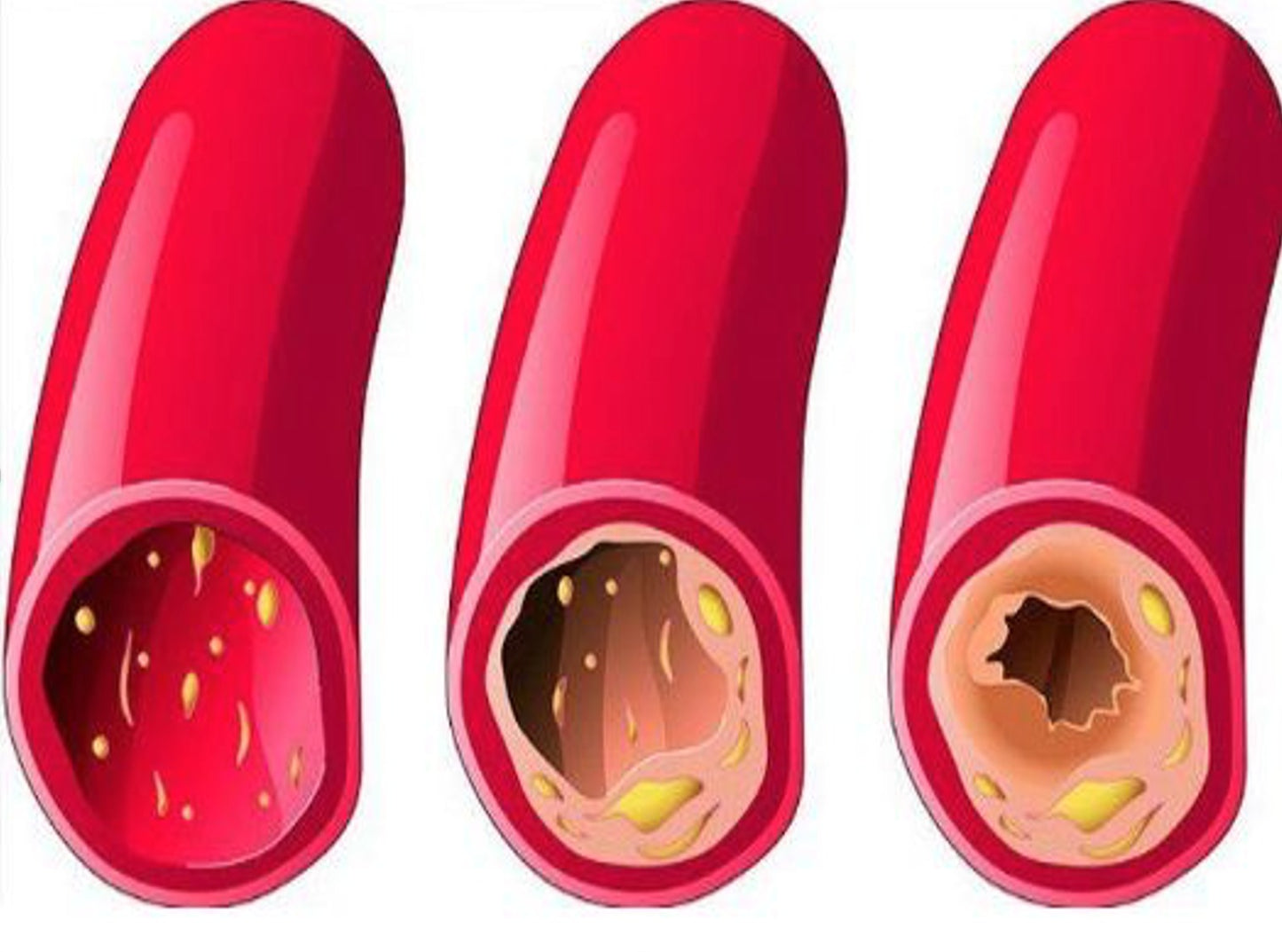 HEART TOOL – Cardiovascular & Blood Flow Support